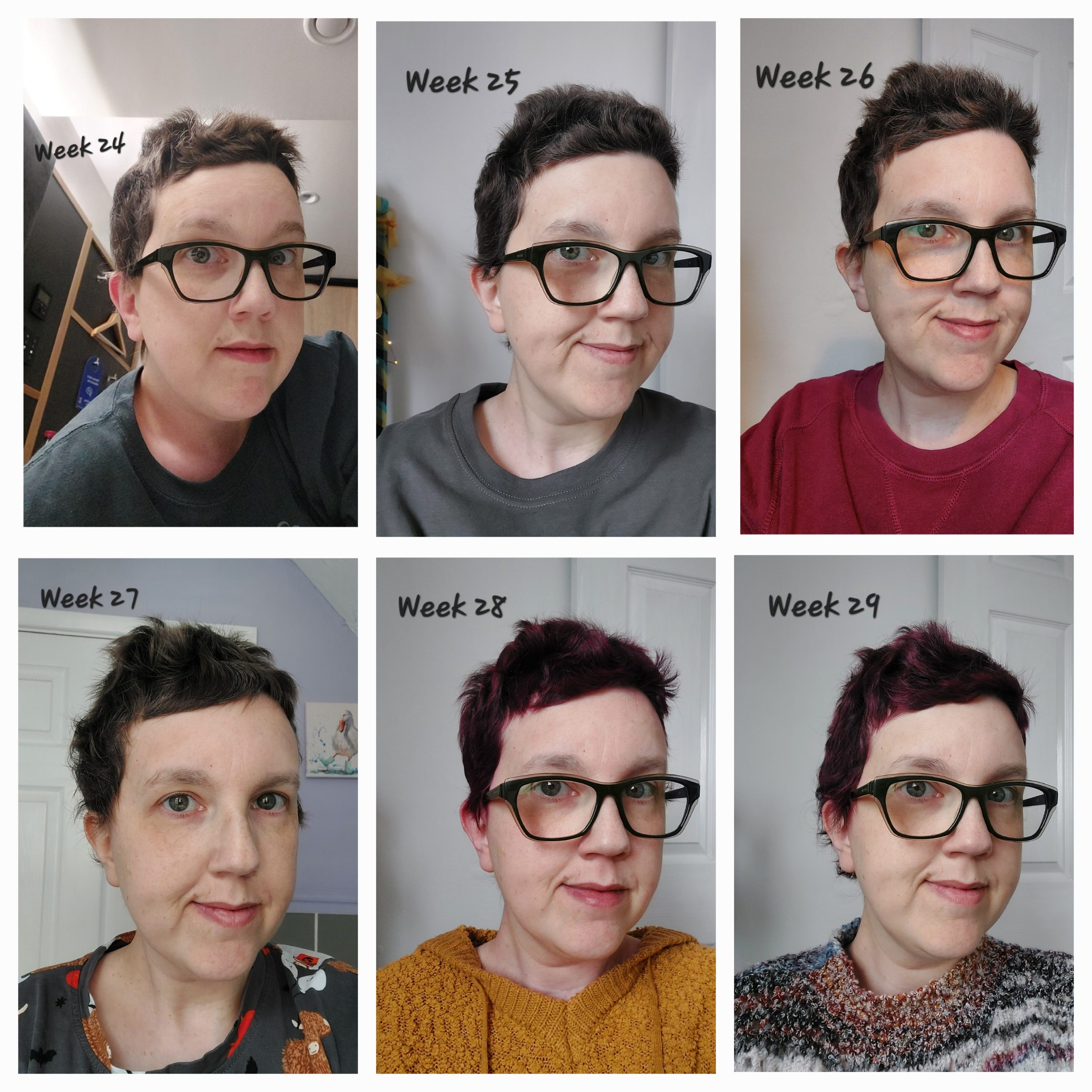 Post-chemo Hair Time-lapse